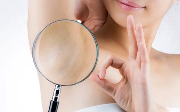 マリアクリニックのミラドライは「最大」出力だから効果が違う